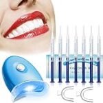 Análisis y comparativa: Los mejores geles blanqueadores dentales del mercado